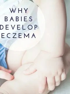 Why Babies Develop Eczema, Diet And Food Ideas To Heal Naturally