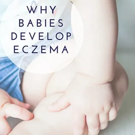 Why Babies Develop Eczema, Diet And Food Ideas To Heal Naturally