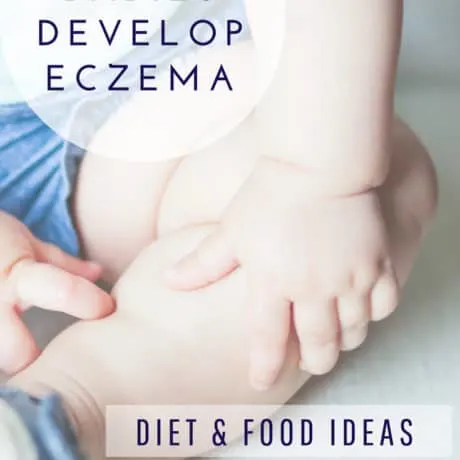 Why Babies Develop Eczema, Diet And Food Ideas To Heal Naturally