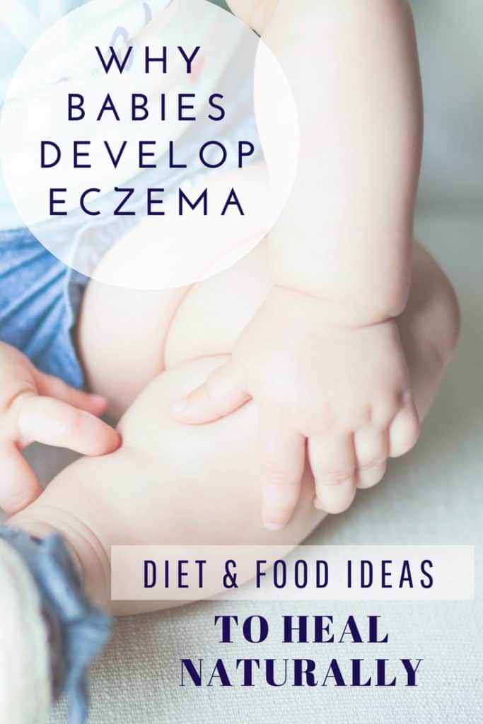 Why Babies Develop Eczema, Diet And Food Ideas To Heal Naturally