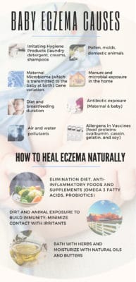 Why Babies Develop Eczema, Ways To Heal It Naturally