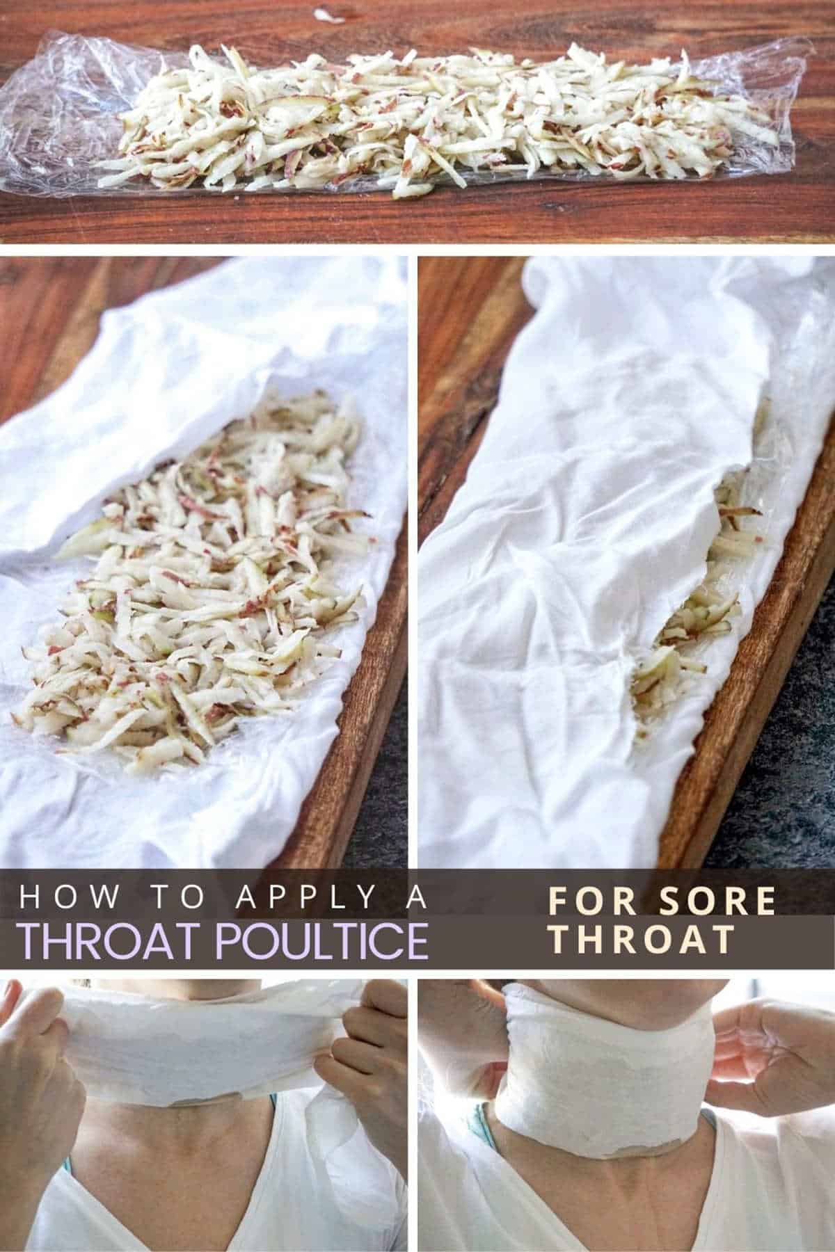 Sore throat natural remedies: potato poultice to relieve sore throat at home. A natural remedy that actually works for adults and kids as well!