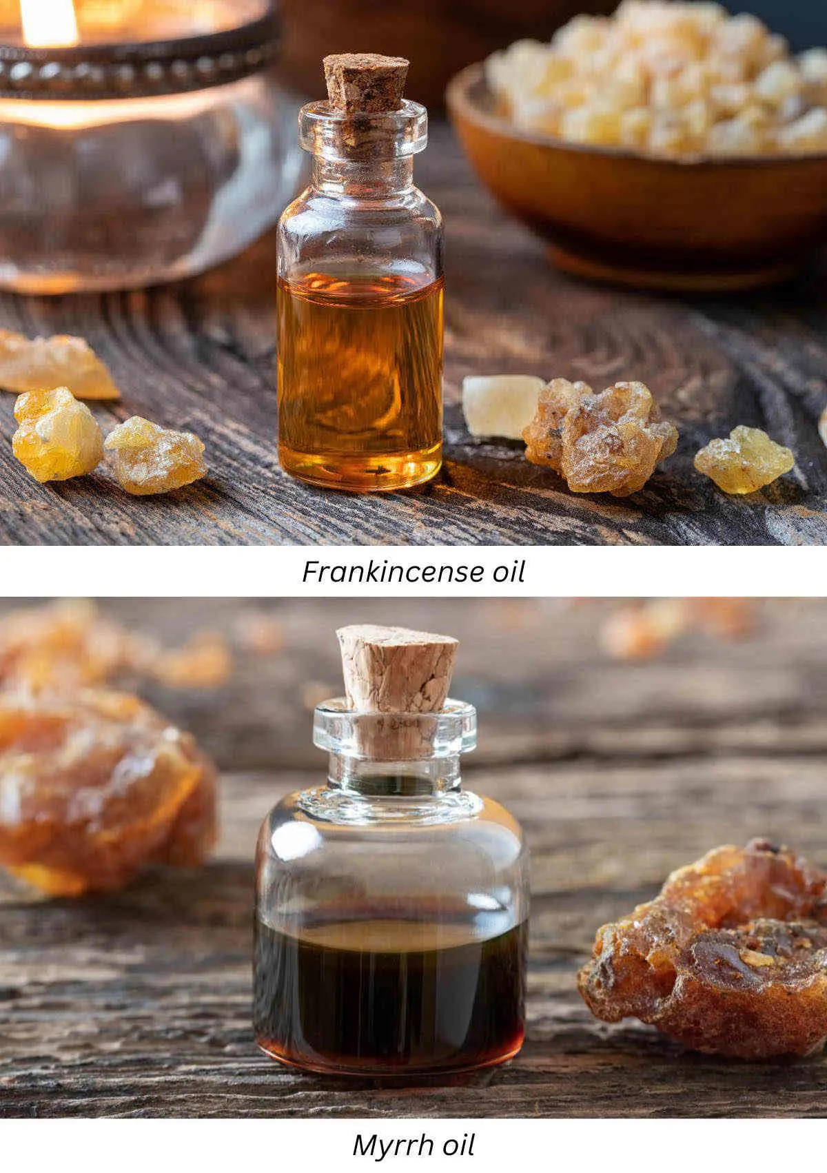 Frankincense oil and myrrh oil for toothache pain inflammation.