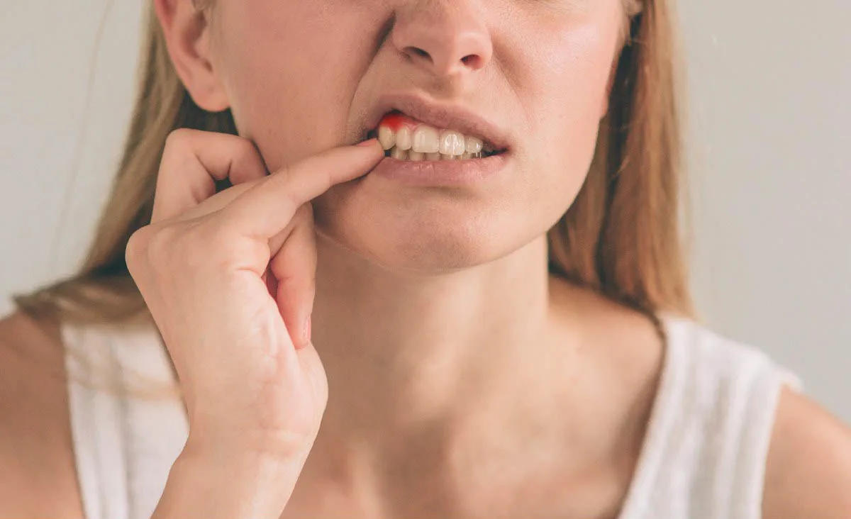 Gum and toothache image.