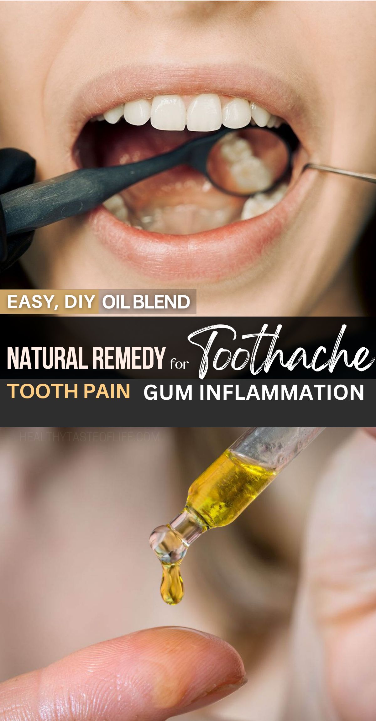 This blend of oils for toothache is a great all-natural home remedy to relieve dental pain and gum inflammation. This DIY oil is great for stopping a toothache whether is dull or throbbing and bring pain relief in minutes. Oils for tooth pain, inflammation; natural home remedy for tooth pain relief, natural antibiotic for toothache and infection. #toothache #painrelief #naturalremedy #toothpain #naturalremedy