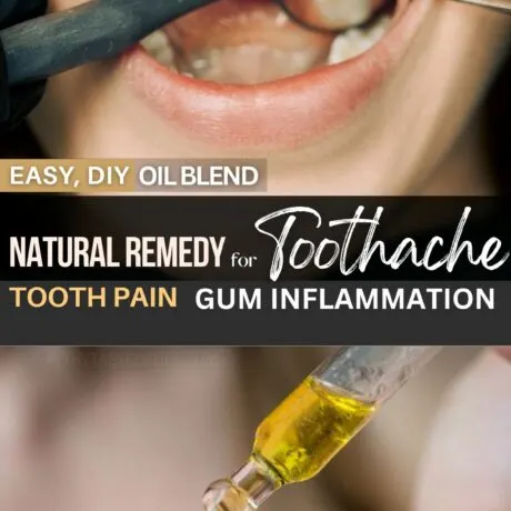 This blend of oils for toothache is a great all-natural home remedy to relieve dental pain and gum inflammation. This DIY oil is great for stopping a toothache whether is dull or throbbing and bring pain relief in minutes. Oils for tooth pain, inflammation; natural home remedy for tooth pain relief, natural antibiotic for toothache and infection. #toothache #painrelief #naturalremedy #toothpain #naturalremedy