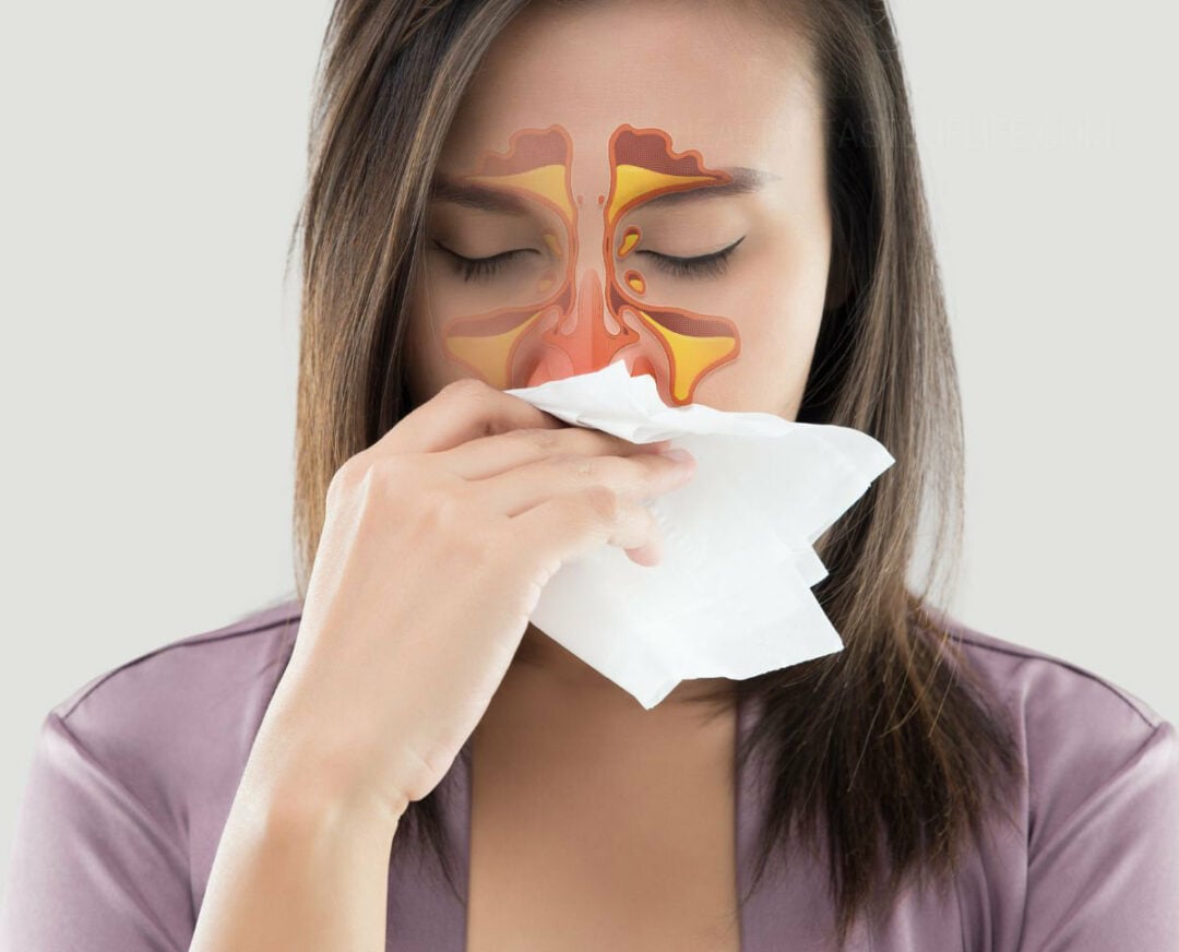 Natural Home Remedies For Sinus Infection (Without Antibiotics) Healthy Taste Of Life
