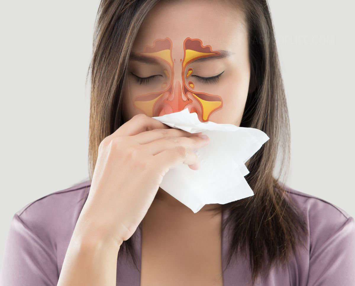 Image showing the location of sinuses nad potential of a sinus infection.
