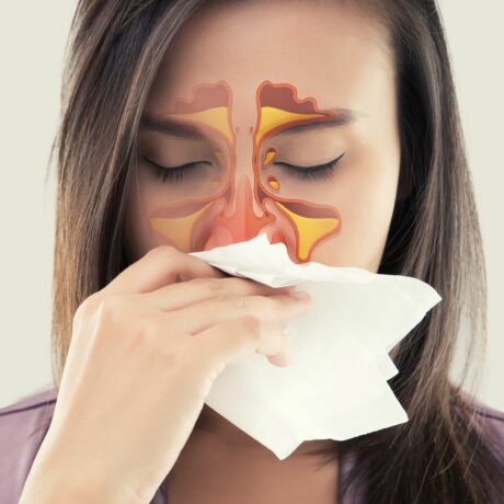 natural remedies for sinus infection without antibiotics