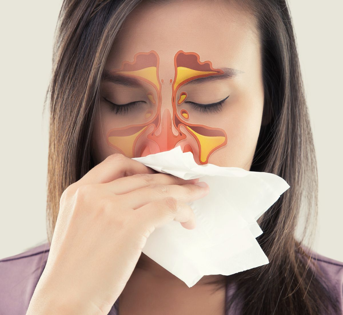 natural remedies for sinus infection without antibiotics