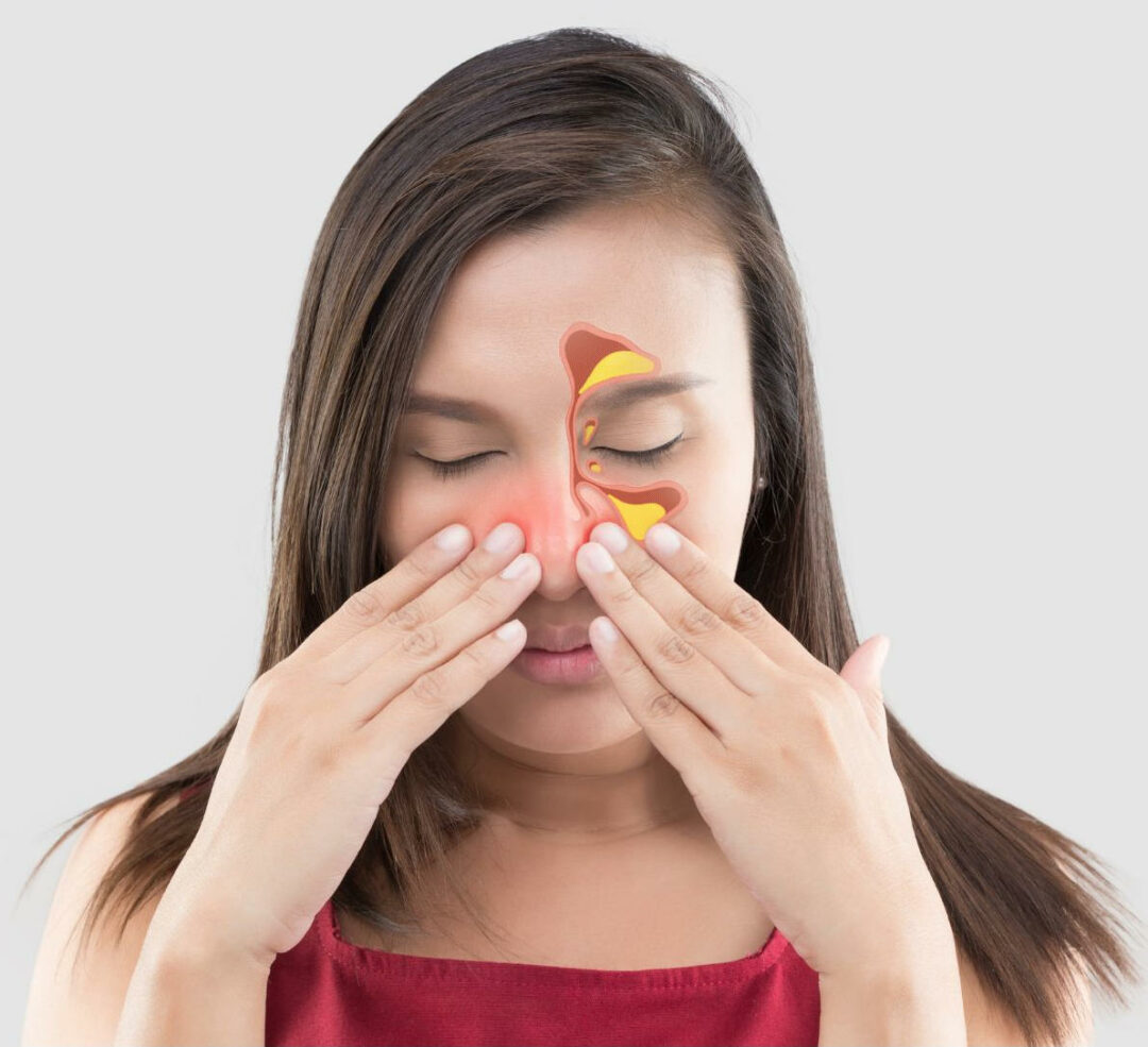 natural-home-remedies-for-sinus-infection-without-antibiotics